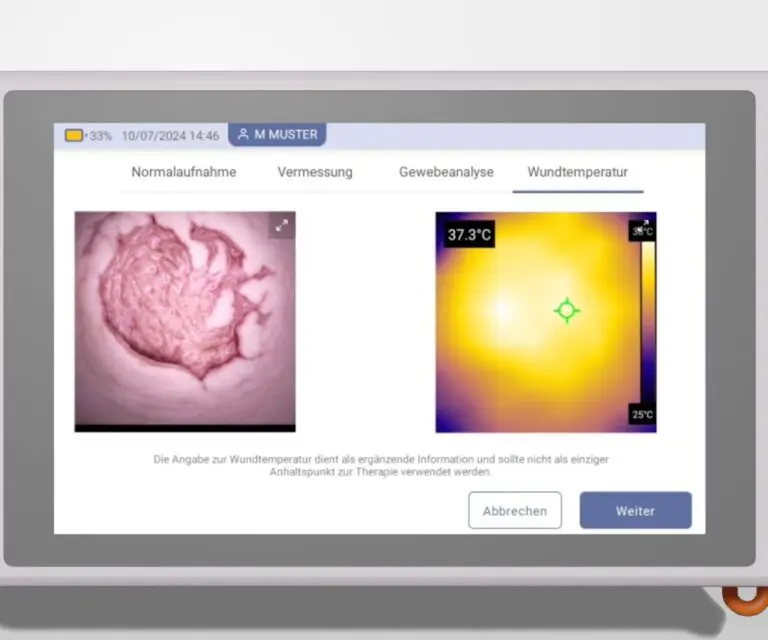 Mit Hilfe von KI werden Wundstruktur und -beschaffenheit blitzschnell ermittelt.